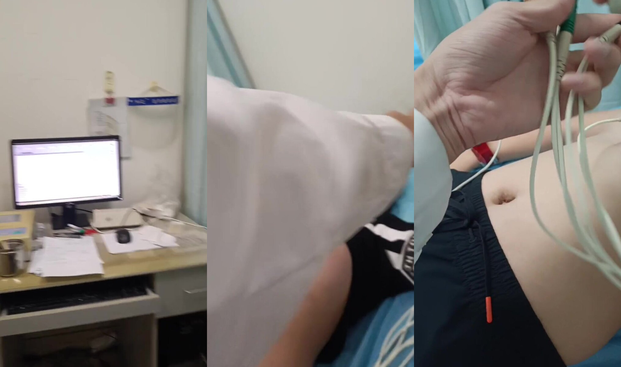 國中妹妹做心電圖